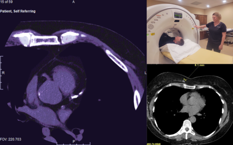 Heart Health and Cardiac Imaging: What Your Scan Can Reveal