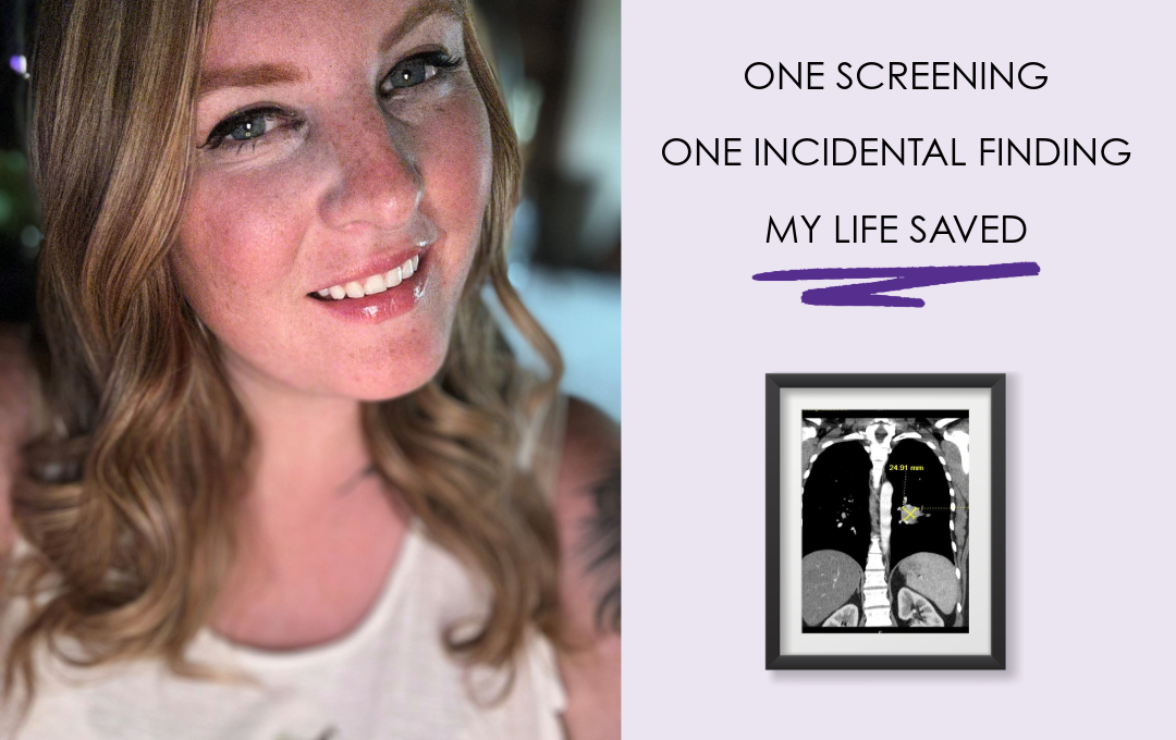 How a Scan Changed Everything: Why Early Screenings Save Lives